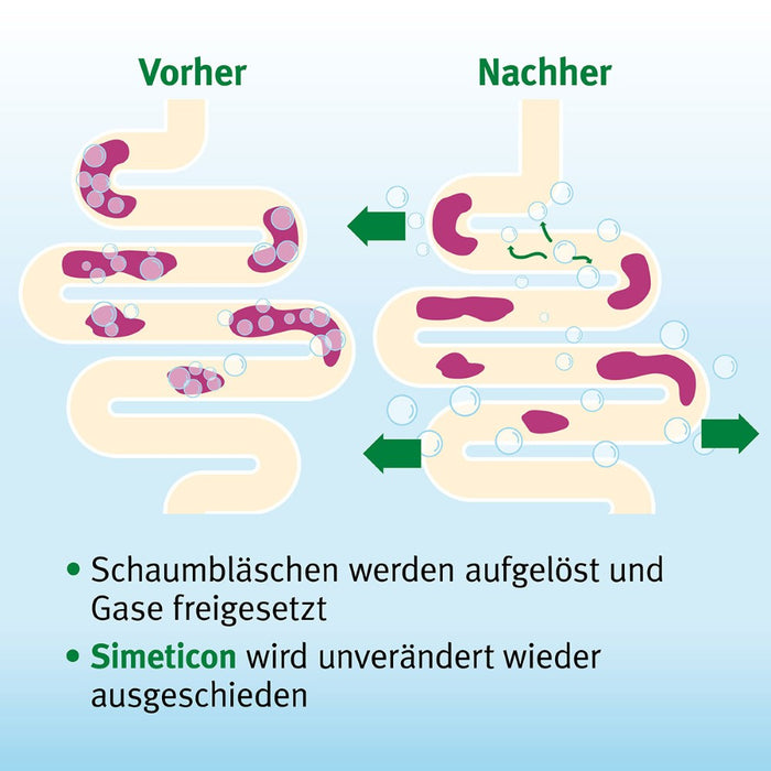 Espumisan Perlen bei Blähungen, 100 St. Kapseln