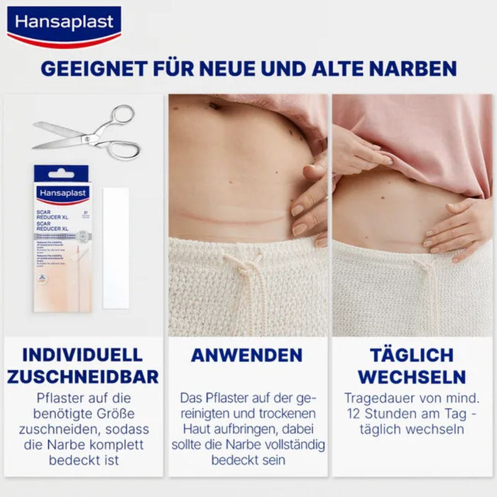 Hansaplast Pflaster zur Behandlung von Narben, 21 St. Pflaster