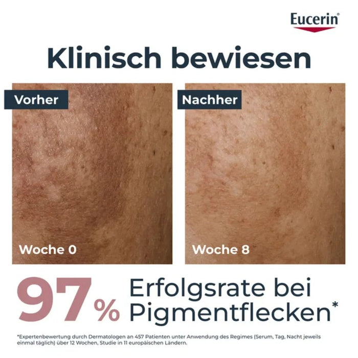 Eucerin Anti-Pigment Tag LSF 30 Creme, 50 ml Creme
