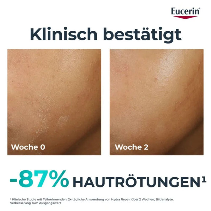 Eucerin Dermopure Hydra Repair Feuchtigkeitspflege für zu Akne neigende Haut, 40 ml Cream