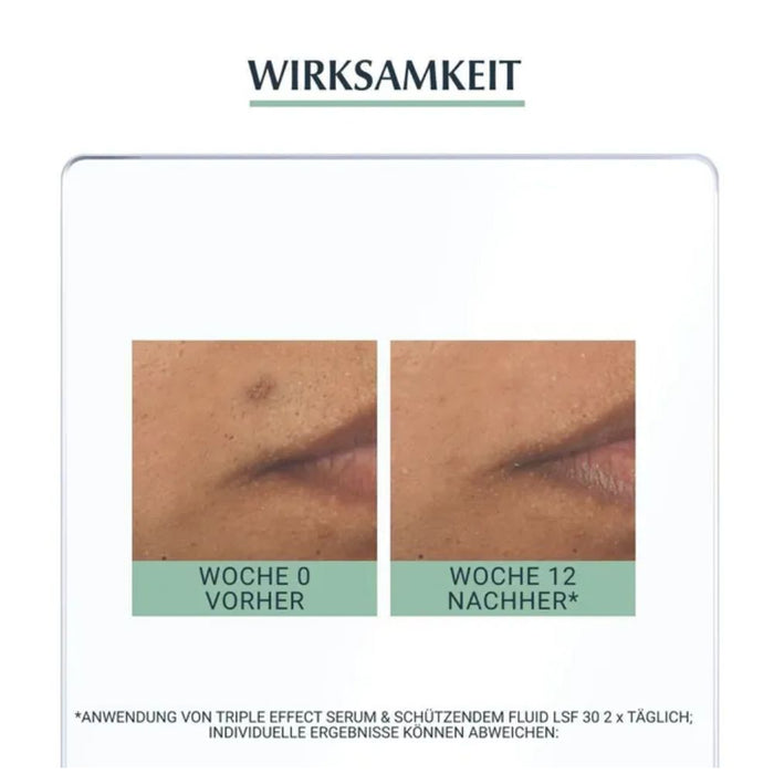 Eucerin Dermopure Triple Effect Gesichtsserum gegen unreine Haut, Pickelmale und glänzende Haut, 40 ml Solution