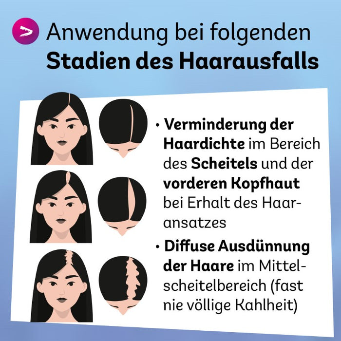 Minoxidil Dexcel 20 mg/ml Spray für Frauen zur Anwendung auf der Haut (Kopfhaut), 180 ml Solution