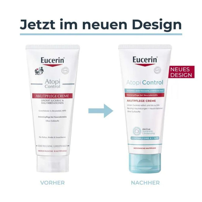 Eucerin AtopiControl Akutpflege Creme reduziert Juckreiz und lindert Rötungen und Hautreizungen, 100 ml Creme