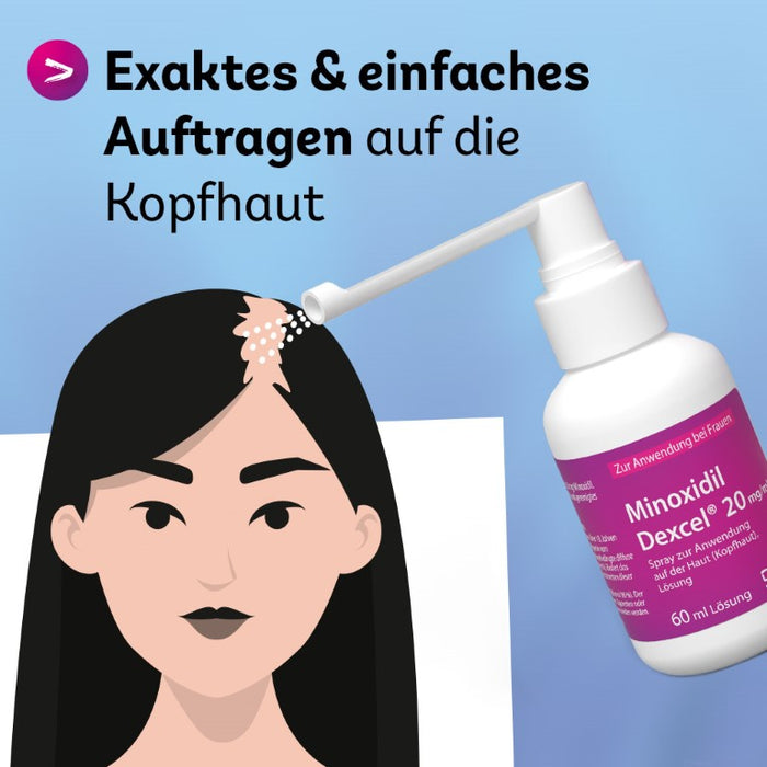 Minoxidil Dexcel 20 mg/ml Spray für Frauen zur Anwendung auf der Haut (Kopfhaut), 180 ml Solution